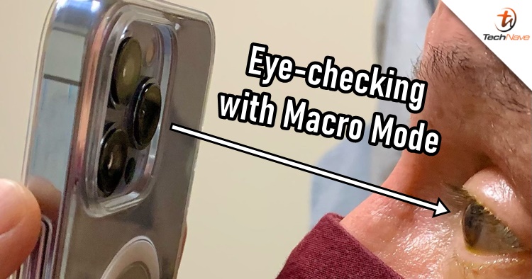 A doctor is using his iPhone 13 Pro Max's Macro Mode to check his patient's eyes