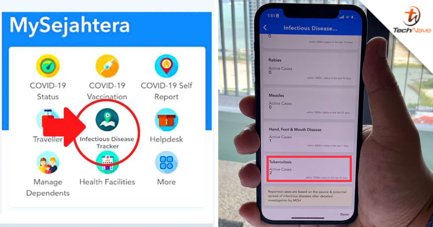 MySejahtera adds Tuberculosis cases to its Infectious Disease Tracker feature
