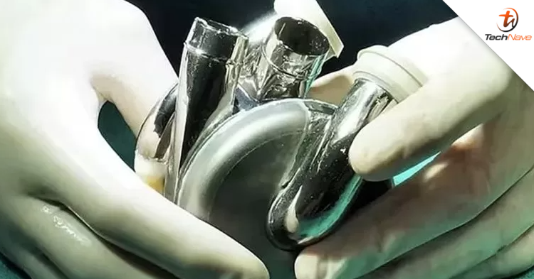 This Australian man survives more than 100 days with a Titanium heart