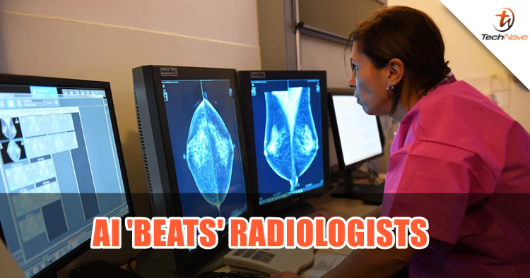 AI is now able to detect breast cancer better than radiologists