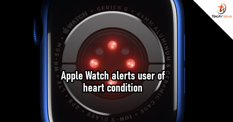 Apple Watch notification alerted user of abnormal heart rate